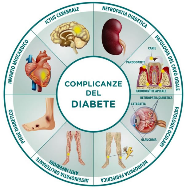 Diabete - Alimentazione